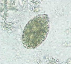 Diphyllobothrium latum