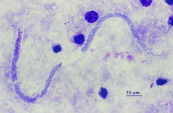 Dipetalonema (Mansonella) sp.