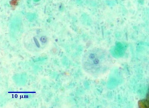 Entamoeba hartmanni