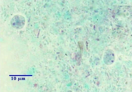 Endolimax nana