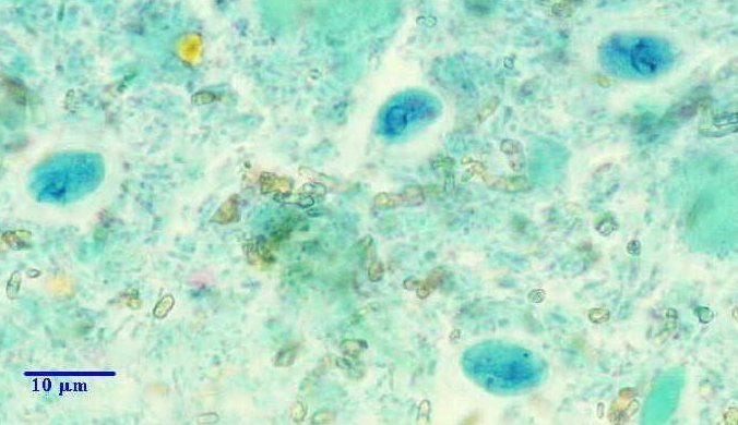 Giardia intestinalis