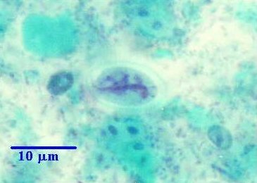 Giardia intestinalis