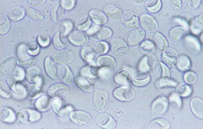 Giardia intestinalis