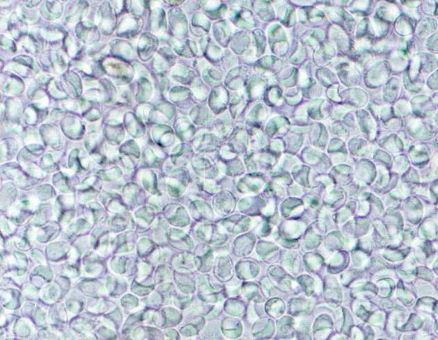 Giardia intestinalis