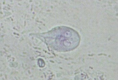 Giardia intestinalis
