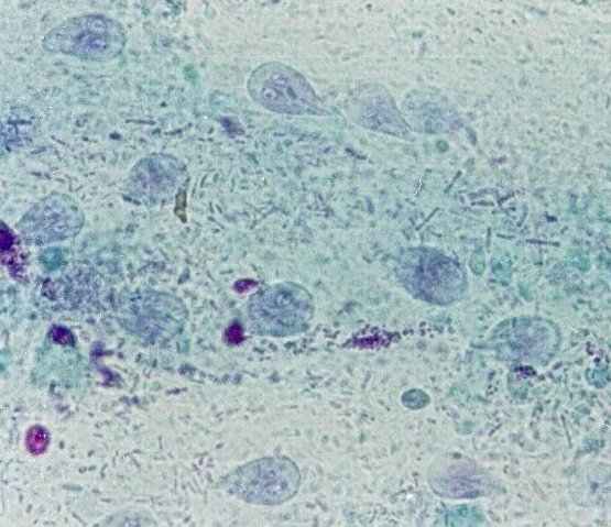 Giardia intestinalis