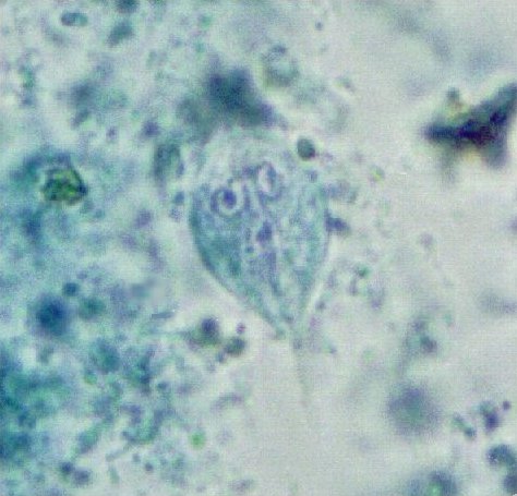 Giardia intestinalis