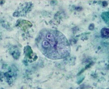 Giardia intestinalis