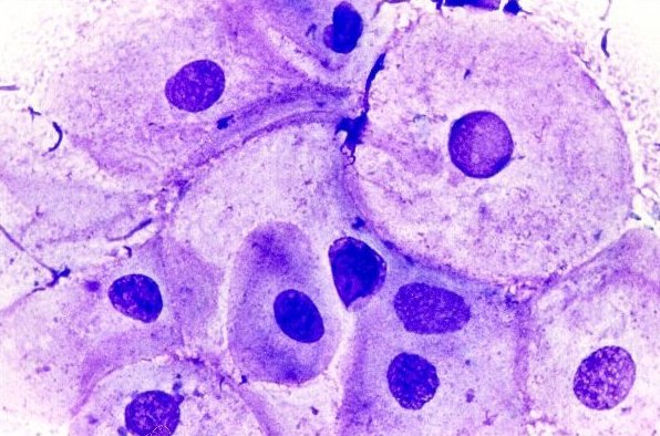 Pictures of vaginal smears