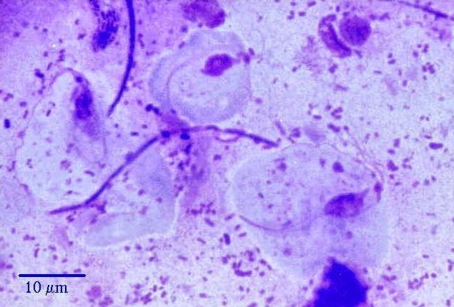 Trichozoa