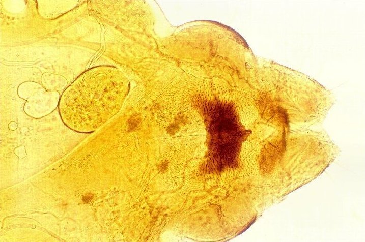 Pediculus capitis