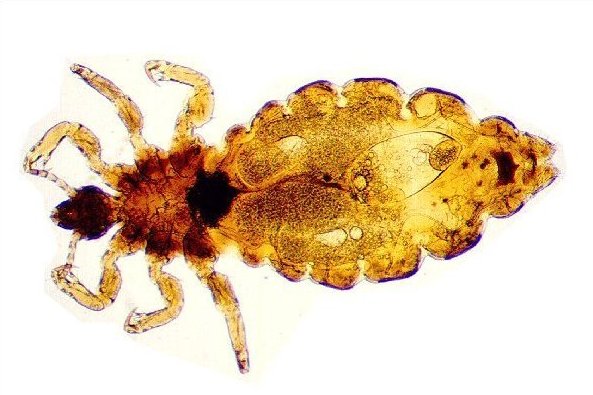 Pediculus capitis