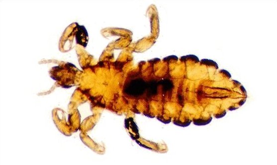 Pediculus capitis