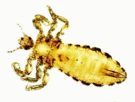 Pediculus humanus