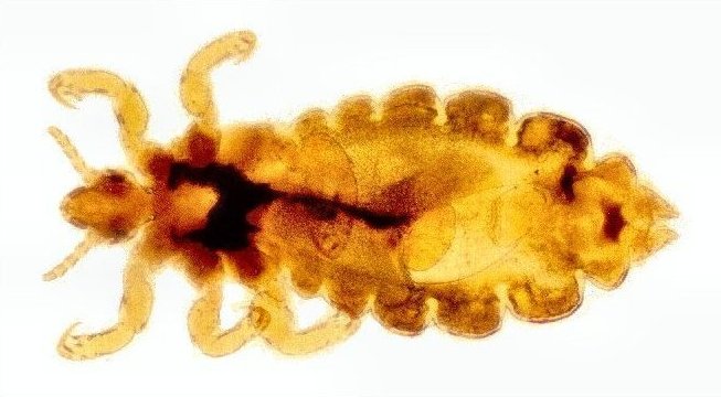 Pediculus humanus