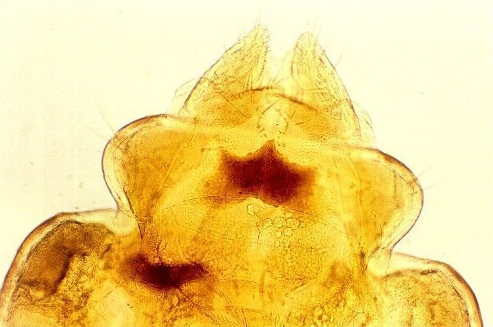 Pediculus humanus
