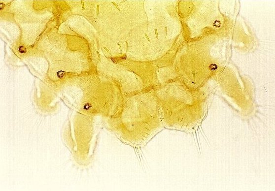 Phthirus pubis
