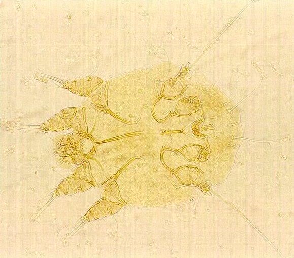 Sarcoptes scabiei