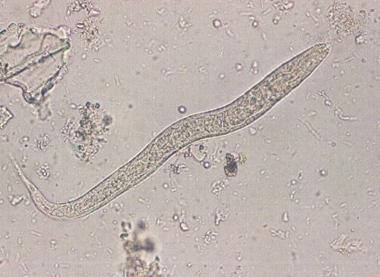 Strongyloides stercoralis