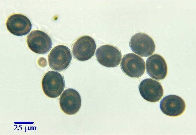 Taenia sp.