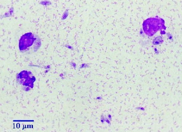 Toxoplasma gondii