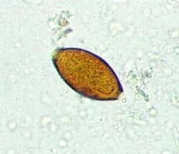 Trichuris trichiura